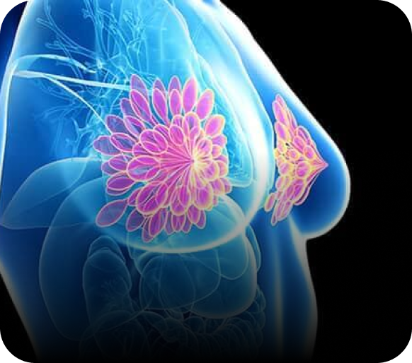 Breast Oncology